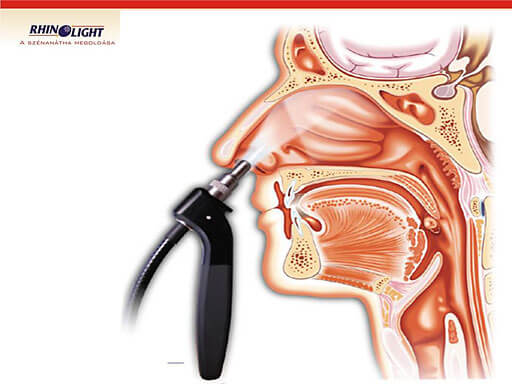 rhinolight